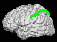 dyscalculia_3.png
