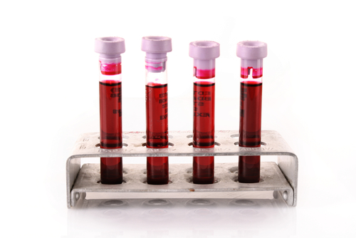 blood_tests_4.jpg
