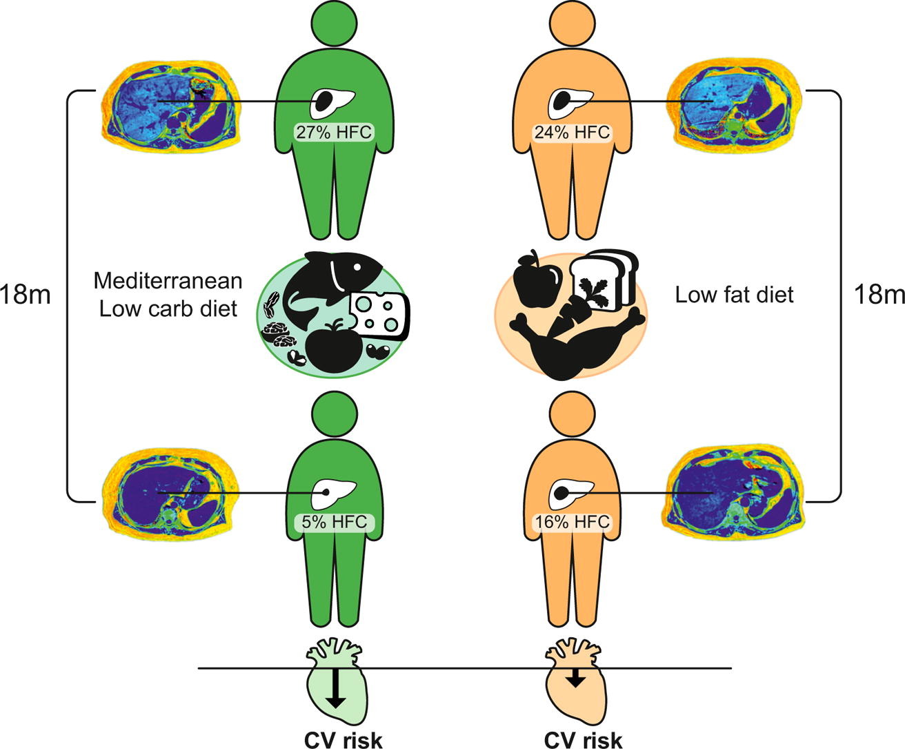 MRI fat.jpg